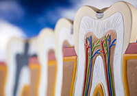 虫歯予防･治療 イメージ画像