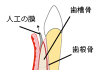 GTR法 イメージ画像